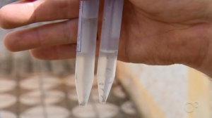 Segunda morte por chikungunya é registrada em Uberlândia