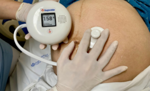 Hapvida NDI lança detector de frequência cardíaca fetal